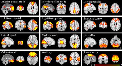 Increased Within-Network Functional Connectivity May Predict NEDA Status in Fingolimod-Treated MS Patients